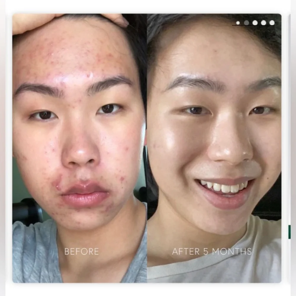 Dr. Barbara Sturm clarifying serum 30ml And Sample Glow Drops. - Picture 2 of 11